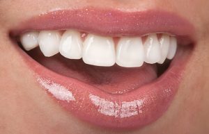 Prótesis Dental Valencia - Logotipo Prótesis López Ferrer